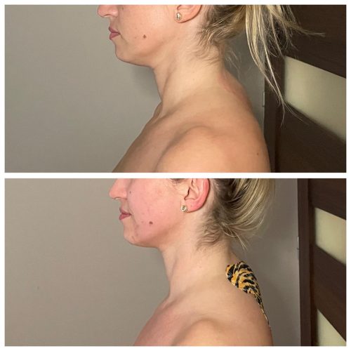 efekty naszej terapi